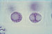 JR00257 interfase mitótica: núcleos mostrando nucléolo(s) com zonas fibrilhar e granular, Vicia faba, coloração de Feulgen